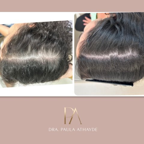 Antes e depois 01
