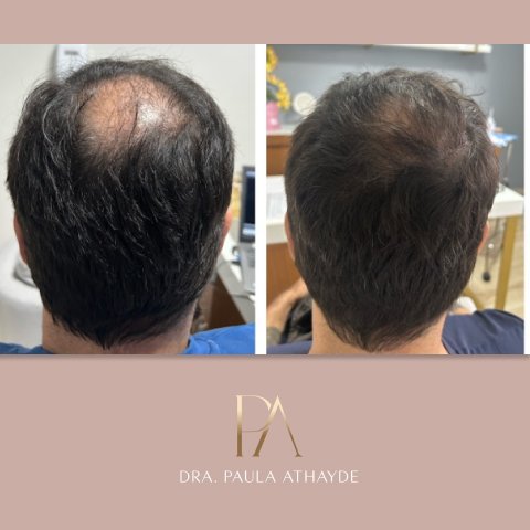Antes e depois 11