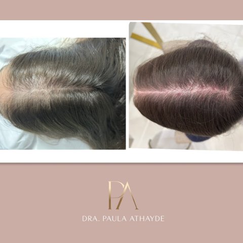 Antes e depois 2
