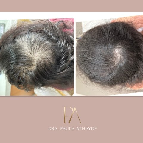 Antes e depois 3