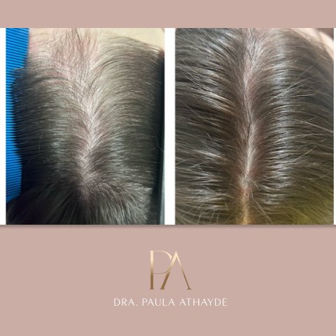 Antes e depois 6